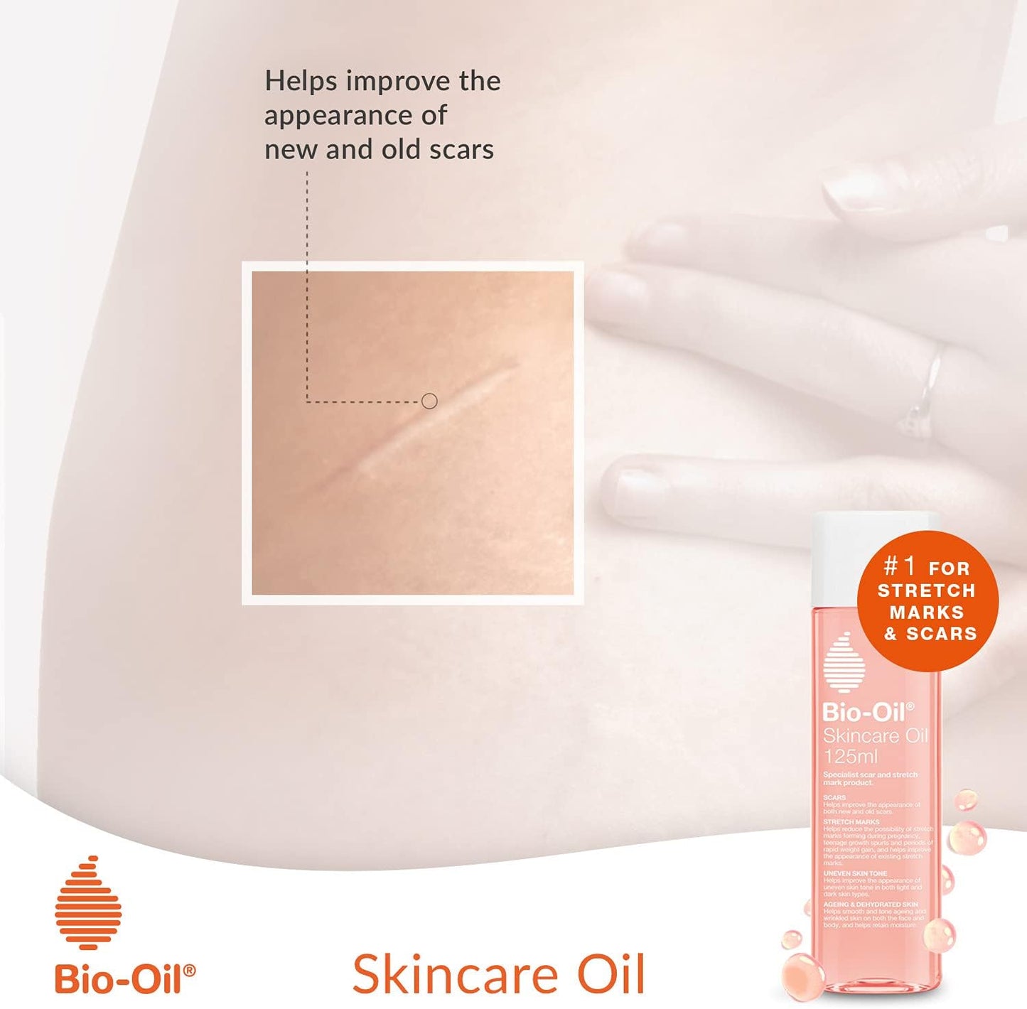 Bio-Oil Skincare Oil - Improve the Appearance of Scars, Stretch Marks and Skin Tone - 1 x 125 ml